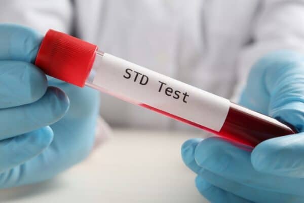 Why STD Screening Is Important—Even on Vacation